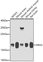 Anti-H-Ras antibody used in Western Blot (WB). GTX55665