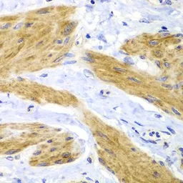 Anti-H-Ras antibody used in IHC (Paraffin sections) (IHC-P). GTX55665
