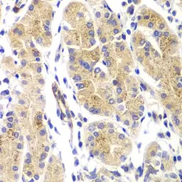Anti-H-Ras antibody used in IHC (Paraffin sections) (IHC-P). GTX55665