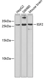 Anti-IGF2 antibody used in Western Blot (WB). GTX55671