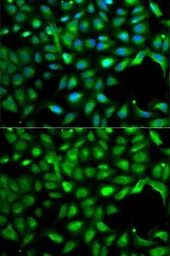 Anti-IGF2 antibody used in Immunocytochemistry/ Immunofluorescence (ICC/IF). GTX55671