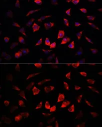 Anti-IGFBP4 antibody used in Immunocytochemistry/ Immunofluorescence (ICC/IF). GTX55672
