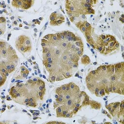 Anti-IGFBP4 antibody used in IHC (Paraffin sections) (IHC-P). GTX55672