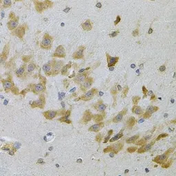 Anti-IGFBP4 antibody used in IHC (Paraffin sections) (IHC-P). GTX55672