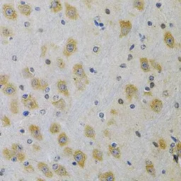 Anti-IGFBP4 antibody used in IHC (Paraffin sections) (IHC-P). GTX55672