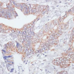 Anti-IKK epsilon antibody used in IHC (Paraffin sections) (IHC-P). GTX55673