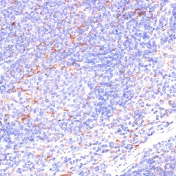 Anti-IKK epsilon antibody used in IHC (Paraffin sections) (IHC-P). GTX55673