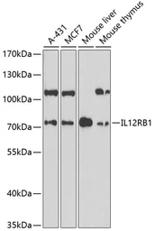 Anti-IL12 Receptor beta1 antibody used in Western Blot (WB). GTX55677