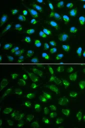 Anti-IL7 antibody used in Immunocytochemistry/ Immunofluorescence (ICC/IF). GTX55679