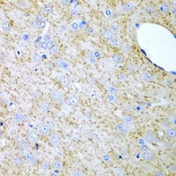 Anti-Inhibin alpha antibody used in IHC (Paraffin sections) (IHC-P). GTX55680