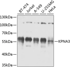 Anti-KPNA3 antibody used in Western Blot (WB). GTX55685
