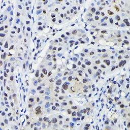 Anti-KPNA3 antibody used in IHC (Paraffin sections) (IHC-P). GTX55685