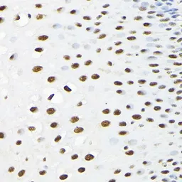 Anti-KPNA3 antibody used in IHC (Paraffin sections) (IHC-P). GTX55685