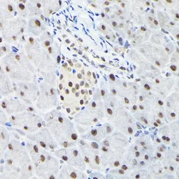 Anti-KPNA3 antibody used in IHC (Paraffin sections) (IHC-P). GTX55685