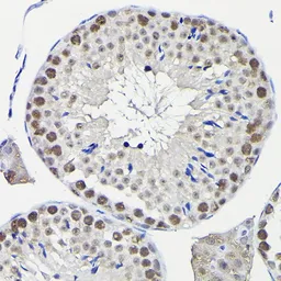 Anti-KPNA3 antibody used in IHC (Paraffin sections) (IHC-P). GTX55685
