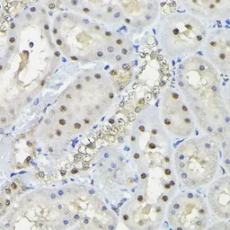 Anti-KPNA3 antibody used in IHC (Paraffin sections) (IHC-P). GTX55685