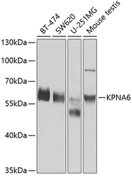Anti-KPNA6 antibody used in Western Blot (WB). GTX55687