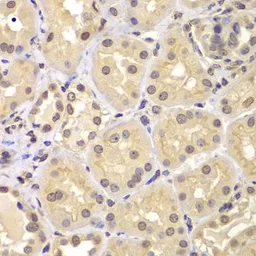 Anti-KPNA6 antibody used in IHC (Paraffin sections) (IHC-P). GTX55687