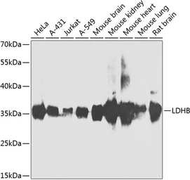 Anti-LDH-B antibody used in Western Blot (WB). GTX55689