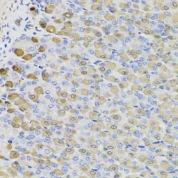 Anti-LDH-B antibody used in IHC (Paraffin sections) (IHC-P). GTX55689