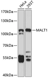 Anti-MALT1 antibody used in Western Blot (WB). GTX55695