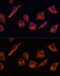 Anti-MALT1 antibody used in Immunocytochemistry/ Immunofluorescence (ICC/IF). GTX55695