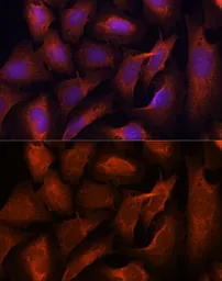 Anti-MALT1 antibody used in Immunocytochemistry/ Immunofluorescence (ICC/IF). GTX55695