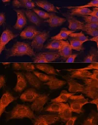 Anti-MALT1 antibody used in Immunocytochemistry/ Immunofluorescence (ICC/IF). GTX55695