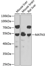 Anti-MATN3 antibody used in Western Blot (WB). GTX55697
