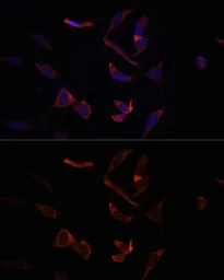Anti-MCL1 antibody used in Immunocytochemistry/ Immunofluorescence (ICC/IF). GTX55698