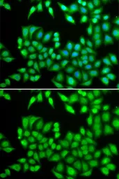 Anti-MCM3 antibody used in Immunocytochemistry/ Immunofluorescence (ICC/IF). GTX55699