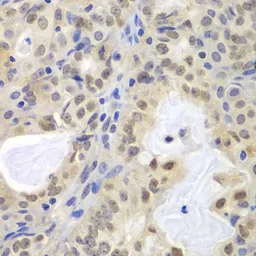 Anti-MCM3 antibody used in IHC (Paraffin sections) (IHC-P). GTX55699