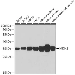Anti-MDH2 antibody used in Western Blot (WB). GTX55700