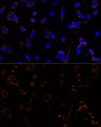Anti-MDH2 antibody used in Immunocytochemistry/ Immunofluorescence (ICC/IF). GTX55700