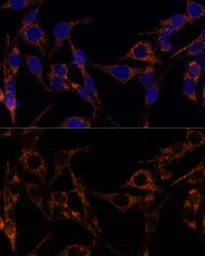 Anti-MDH2 antibody used in Immunocytochemistry/ Immunofluorescence (ICC/IF). GTX55700