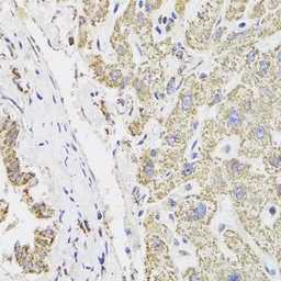 Anti-MDH2 antibody used in IHC (Paraffin sections) (IHC-P). GTX55700