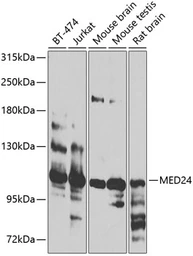 Anti-MED24 antibody used in Western Blot (WB). GTX55701