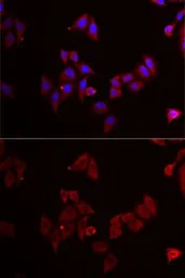 Anti-MEK5 antibody used in Immunocytochemistry/ Immunofluorescence (ICC/IF). GTX55702