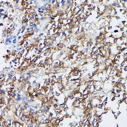 Anti-MEK5 antibody used in IHC (Paraffin sections) (IHC-P). GTX55702