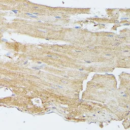 Anti-MEK5 antibody used in IHC (Paraffin sections) (IHC-P). GTX55702