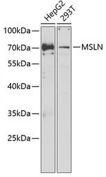 Anti-Mesothelin antibody used in Western Blot (WB). GTX55703