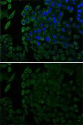 Anti-Mesothelin antibody used in Immunocytochemistry/ Immunofluorescence (ICC/IF). GTX55703