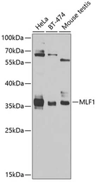 Anti-MLF1 antibody used in Western Blot (WB). GTX55705