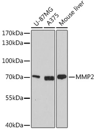 Anti-MMP2 antibody used in Western Blot (WB). GTX55708