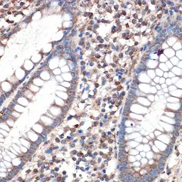 Anti-MMP2 antibody used in IHC (Paraffin sections) (IHC-P). GTX55708
