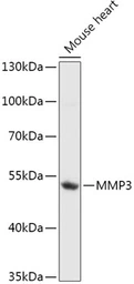 Anti-MMP3 antibody used in Western Blot (WB). GTX55709