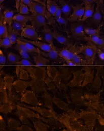 Anti-MMP3 antibody used in Immunocytochemistry/ Immunofluorescence (ICC/IF). GTX55709