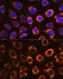 Anti-Monoamine Oxidase B antibody used in Immunocytochemistry/ Immunofluorescence (ICC/IF). GTX55711
