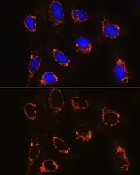 Anti-Monoamine Oxidase B antibody used in Immunocytochemistry/ Immunofluorescence (ICC/IF). GTX55711
