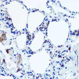 Anti-Monoamine Oxidase B antibody used in IHC (Paraffin sections) (IHC-P). GTX55711